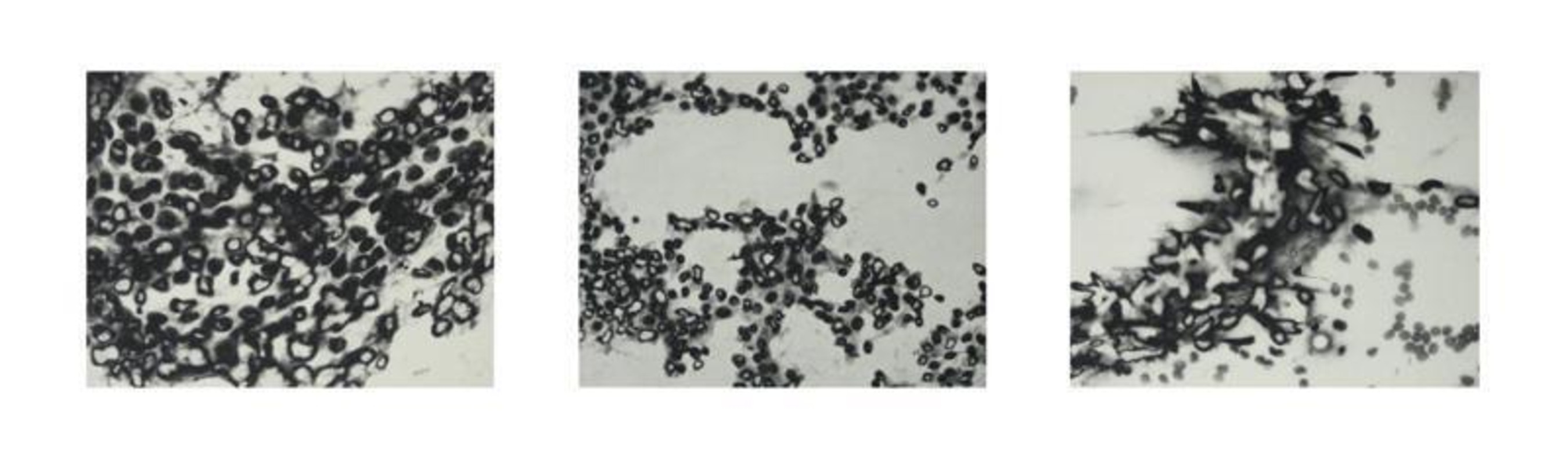 Cancer,Cell Series